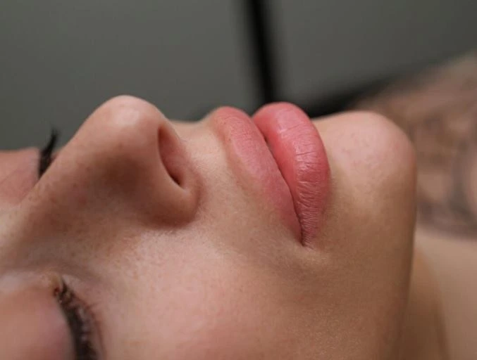 Full lip enhancement treatment Dubai