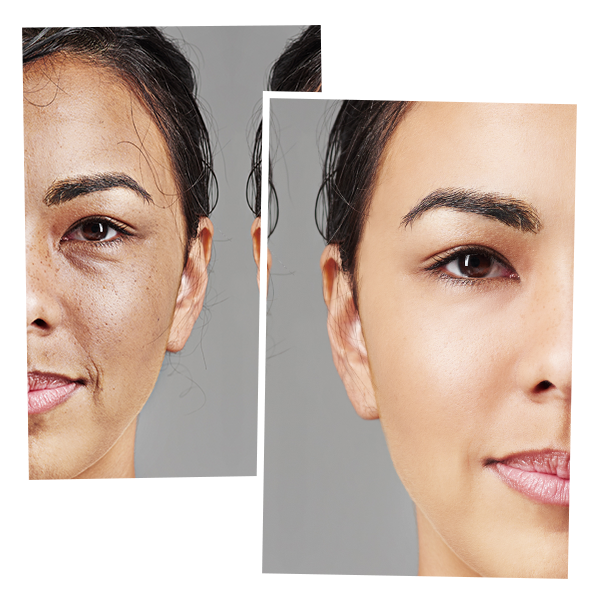 Fillers - Copy (2)