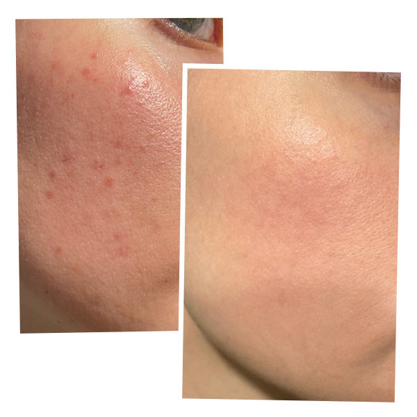 HA Skin BOOSTER