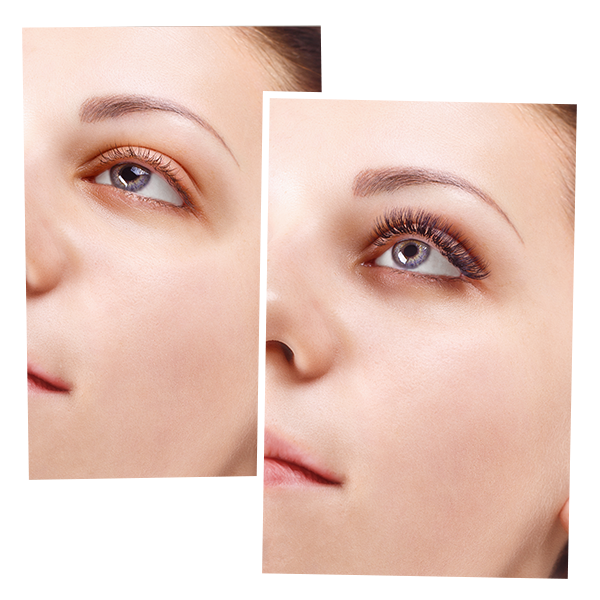 Hydra Facial - Copy (2)