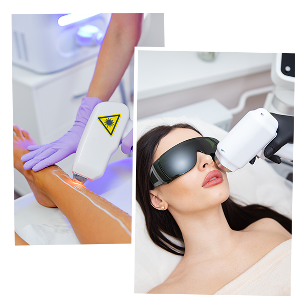 Laser Hair Removal