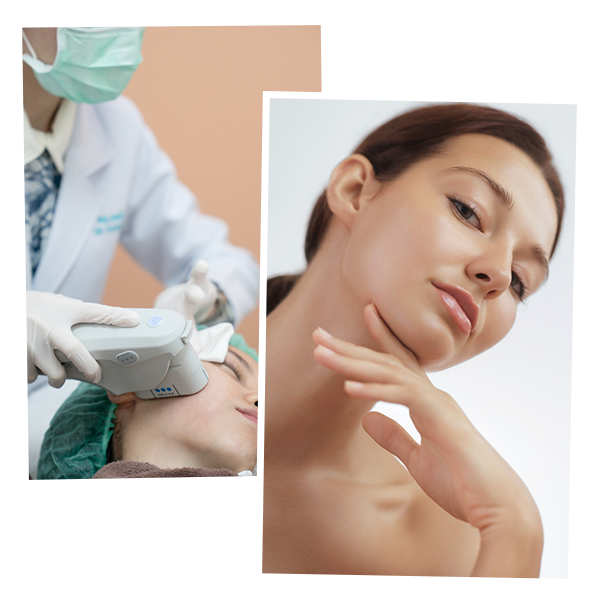 Ultherapy