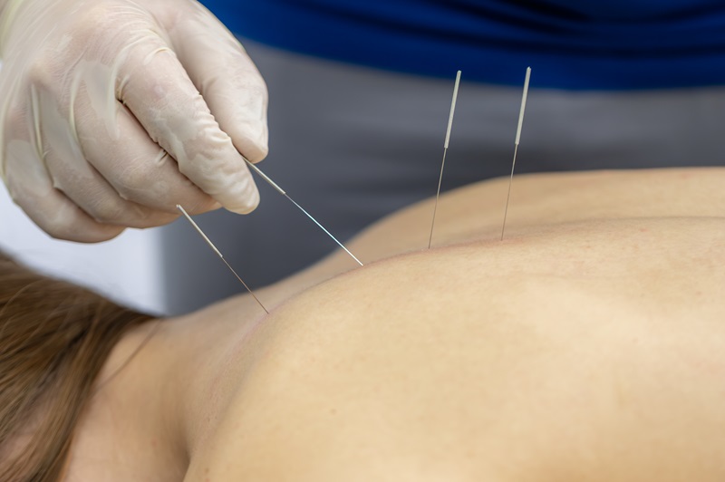 Acupuncture and Modern Healthcare