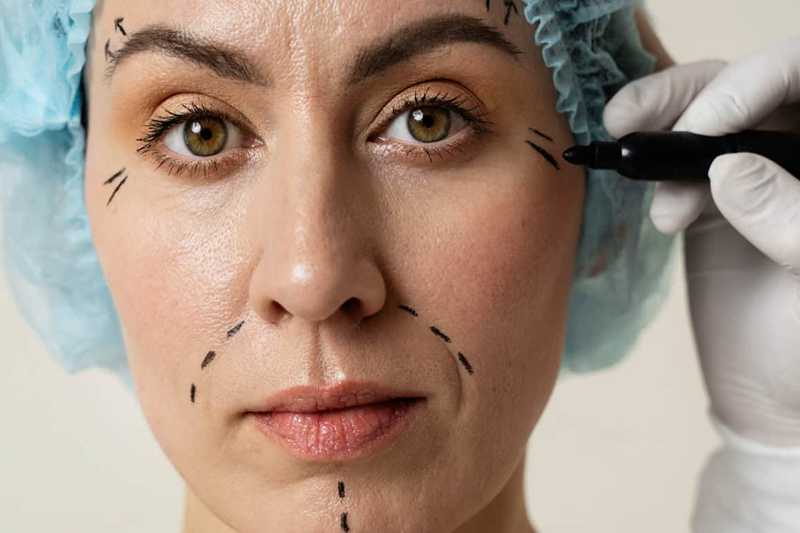 What Is the Difference Between Anti-Wrinkle Injections and Dermal Fillers?