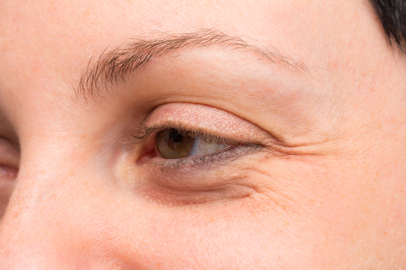 Why Wrinkles Show Up in the First Place