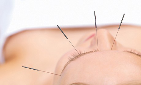Acupuncture Treatment in Dubai