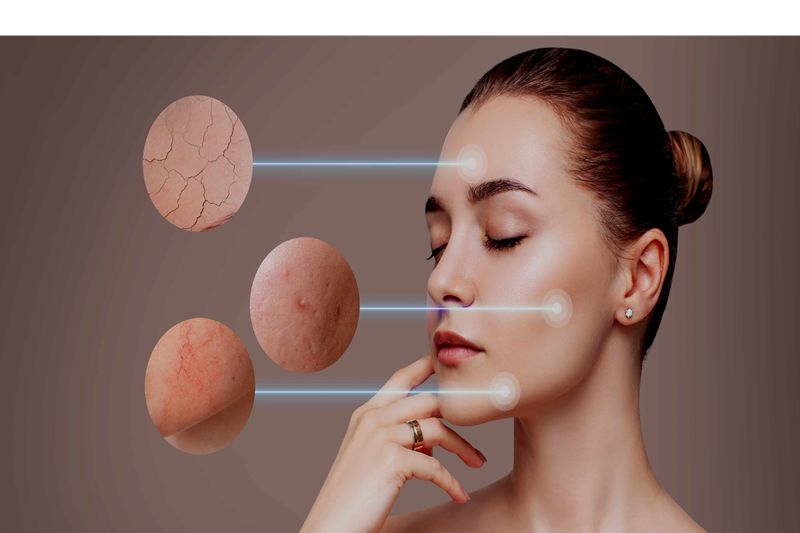 What Causes Uneven Skin Tone?
