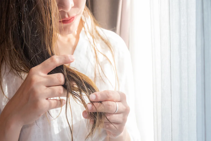 Post Pregnancy Hair Loss: Causes, Treatment & What to Expect