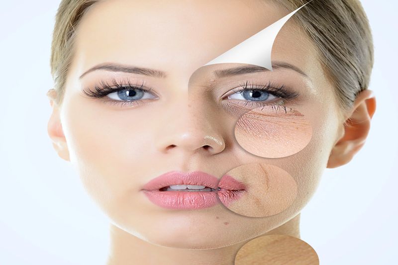 Preventing Fine Lines and Wrinkles