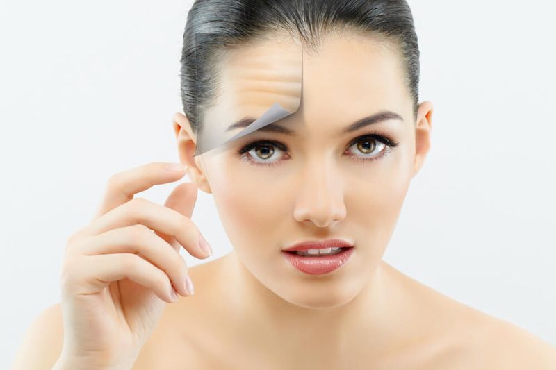 What Are Fine Lines?