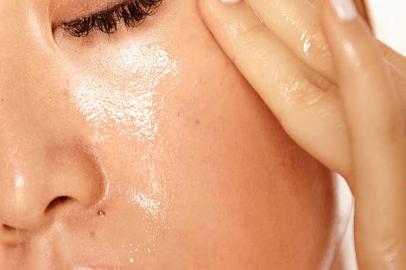 Oily Skin
