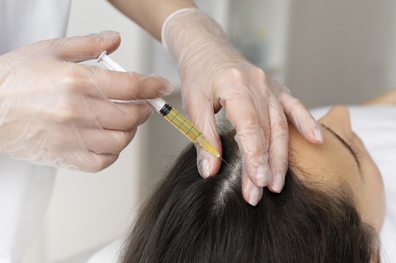 How PRP Works for Hair Growth