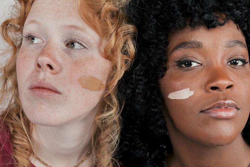 Different Types of Facial Pigmentation
