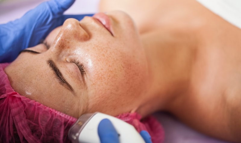 How to Treat Hyperpigmentation