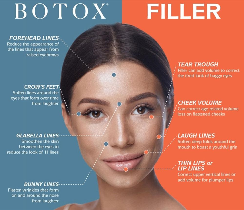 Botox vs. Fillers