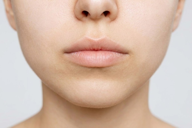 Lip Filler Look Natural