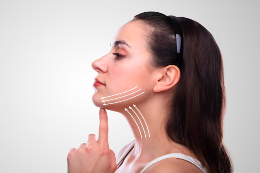What Should You Do After Masseter Botox?