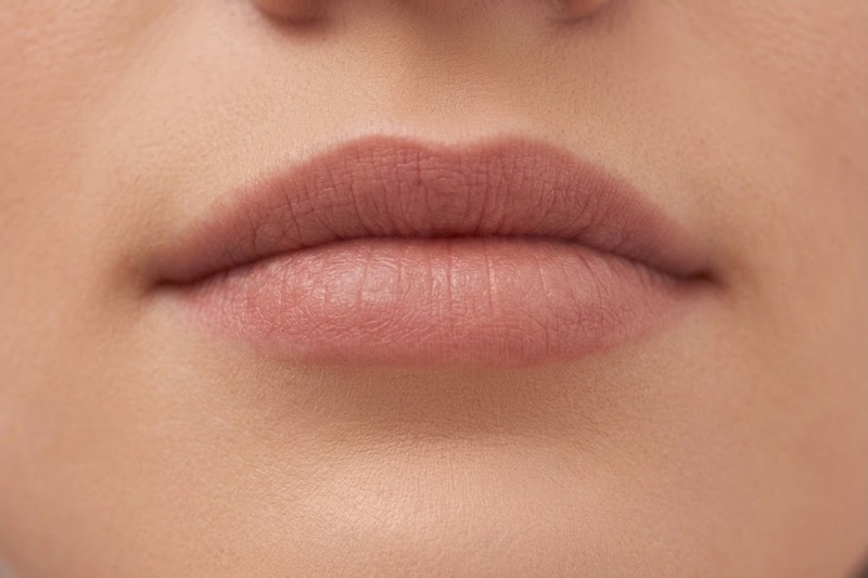 Lip implants