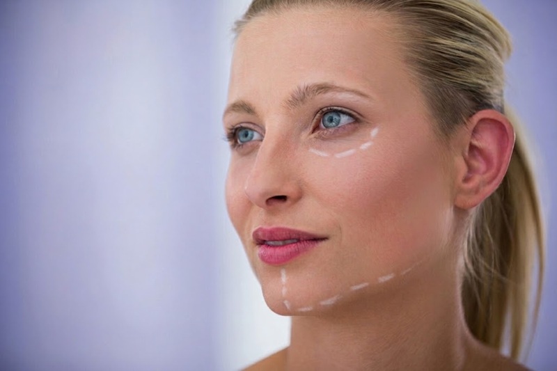 Areas that Botox can Treat
