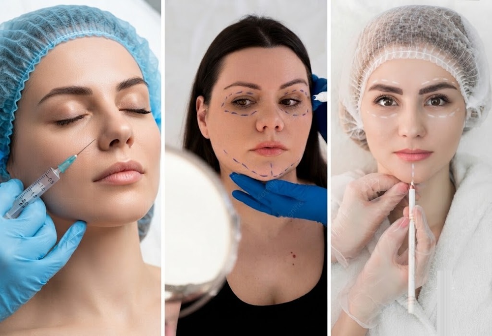 Dermal fillers
