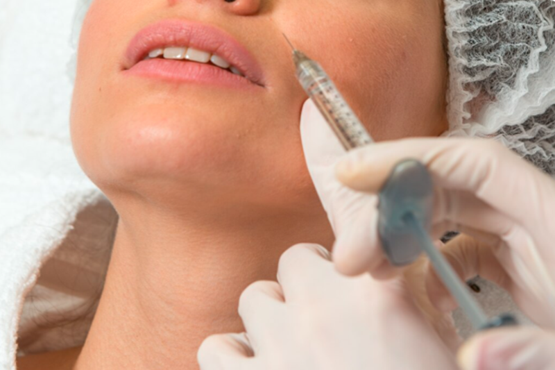 What Are the Main Benefits of Juvederm?