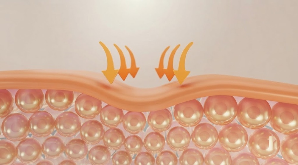 What Are Injectable Collagen Peptides