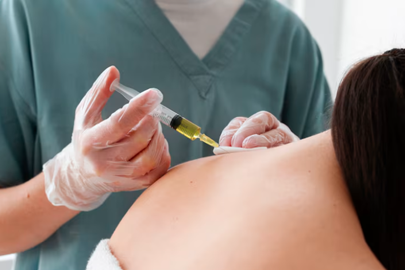 What Is Trapezius Botox?
