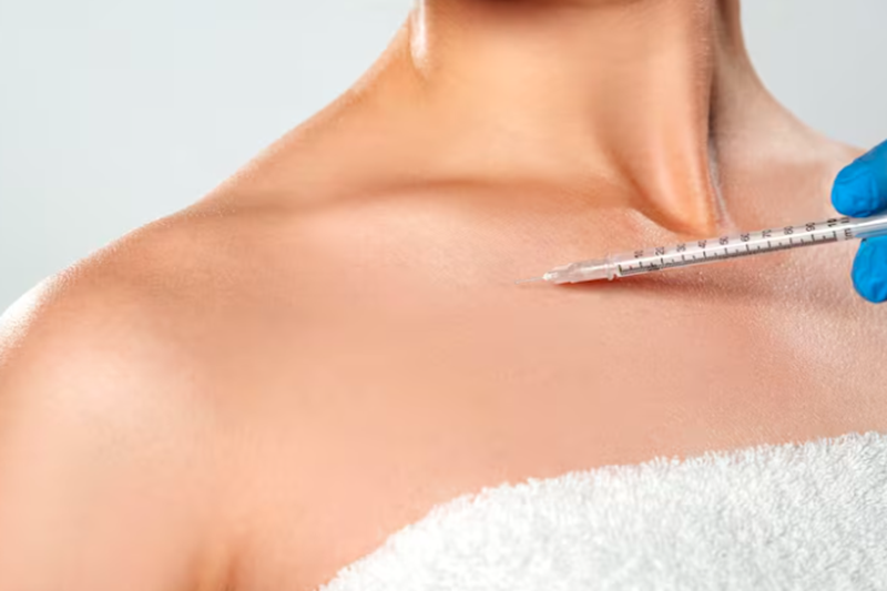 Is Trapezius Botox Painful?