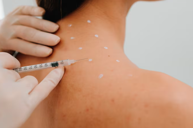 Trap Tox (Trapezius Botox): How It Works & Results