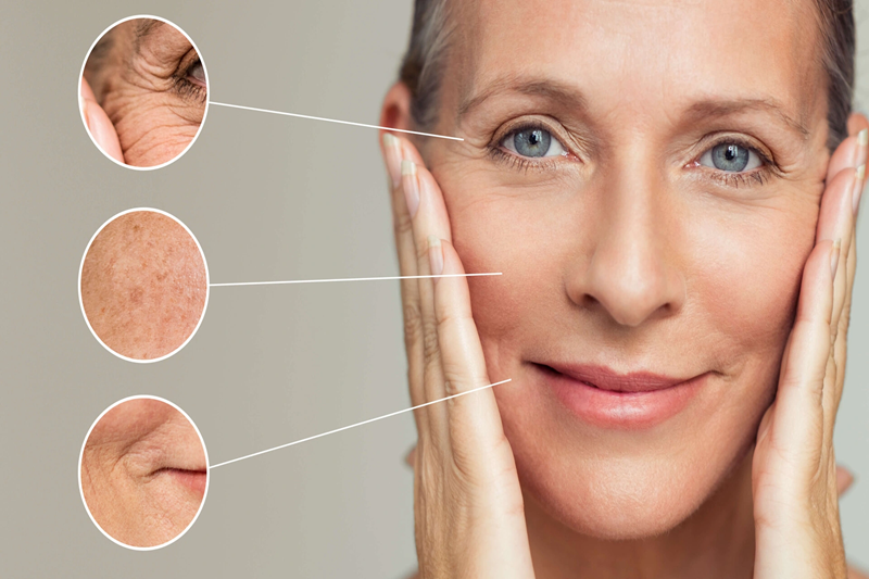 When comparing Filler vs Facelift, longevity is an important difference.
