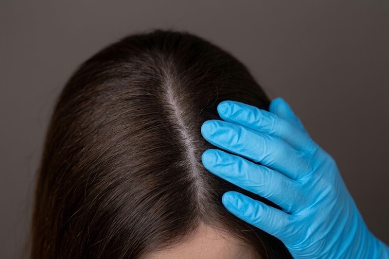 regrow hair.