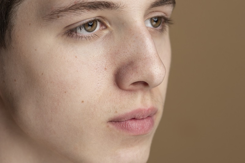 Uneven skin texture with visible pores and rough patches
