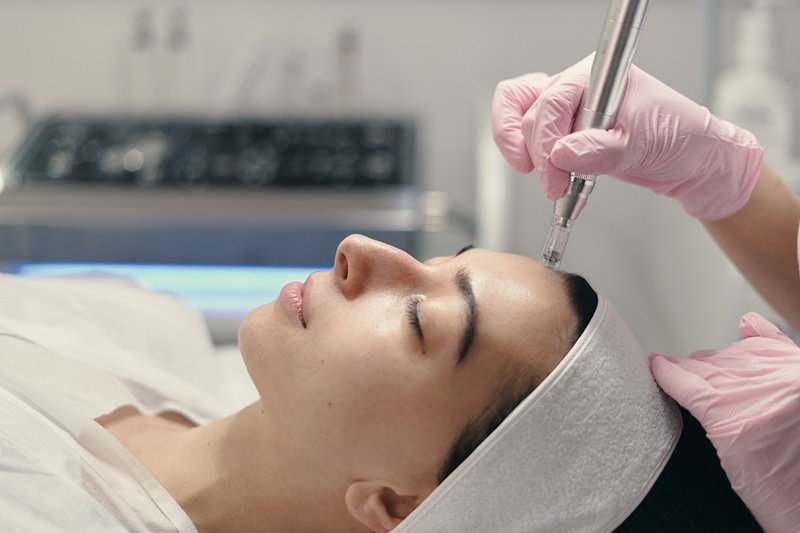 Professional microneedling treatment