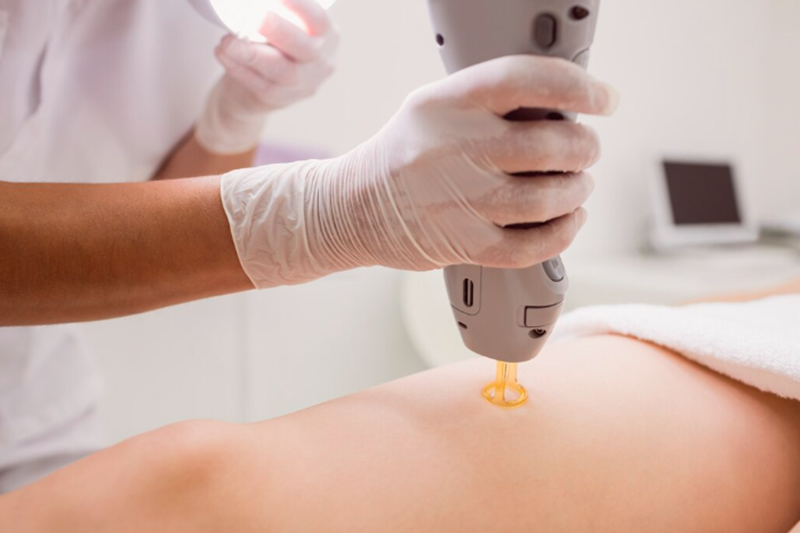 Electrolysis hair removal treatment using a fine probe