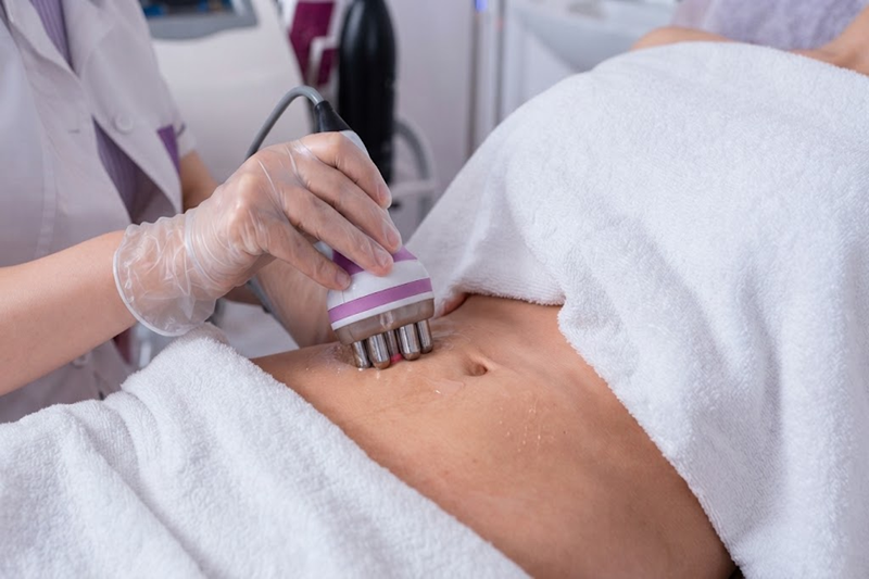 Body sculpting treatment for belly fat